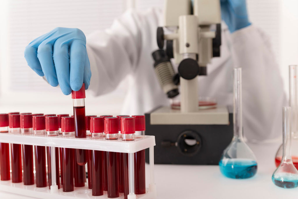 Complete Blood Count (CBC)