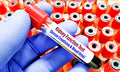 Kidney Function Test (KFT / RFT)