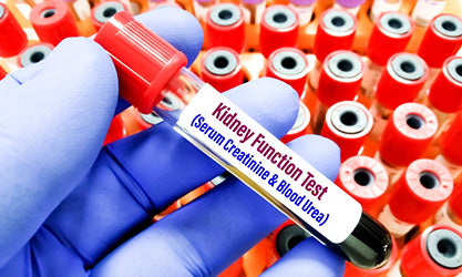 Kidney Function Test (KFT / RFT)