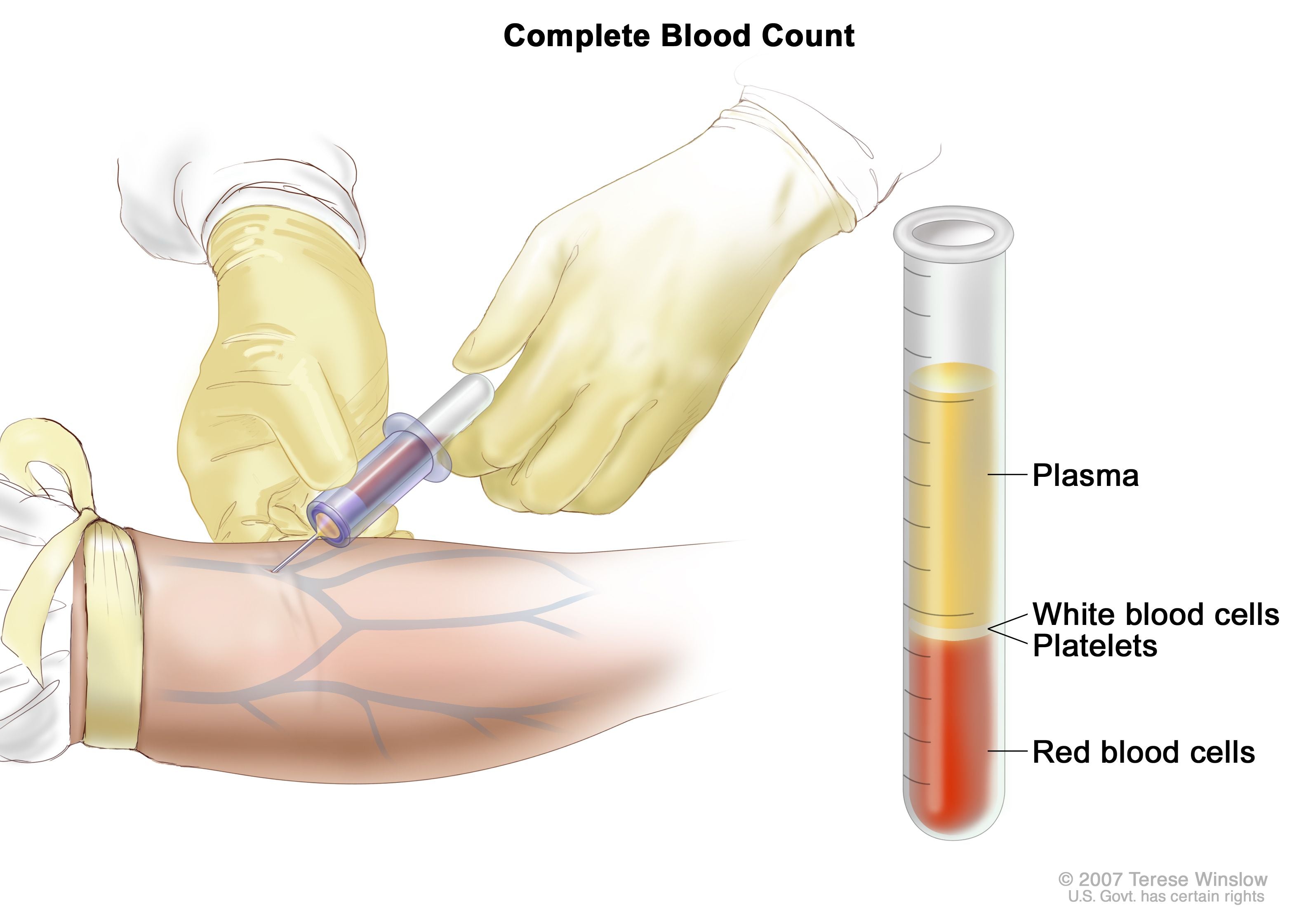 Complete Blood Count (CBC)