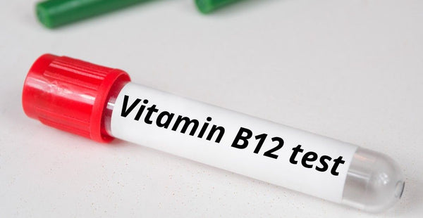 Vitamin B12 Test