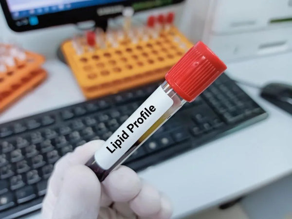 Lipid Profile (Cholesterol Panel)