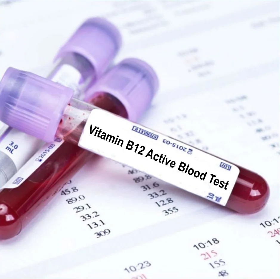 Vitamin B12 Test