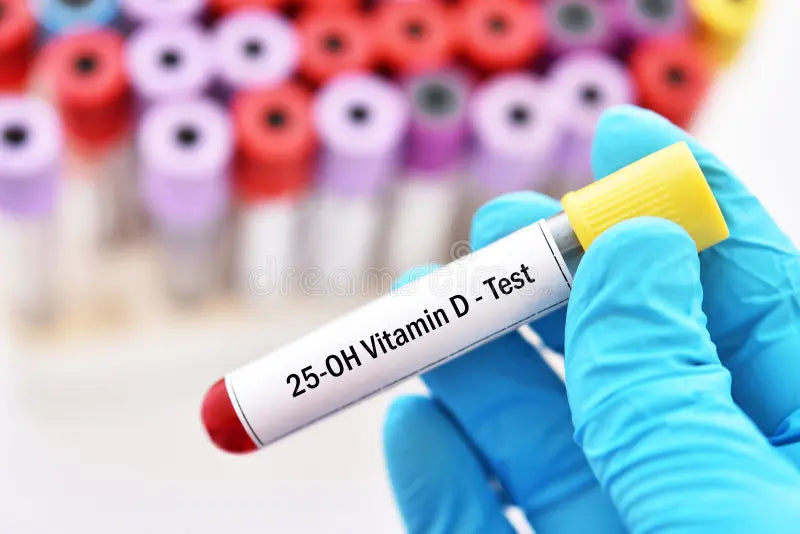 Vitamin D (25-OH) Test