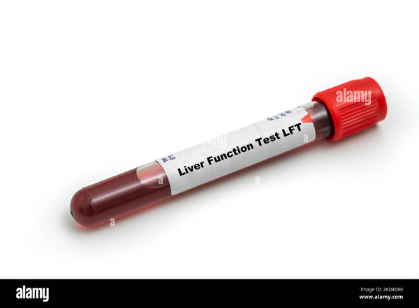 Liver Function Test (LFT)