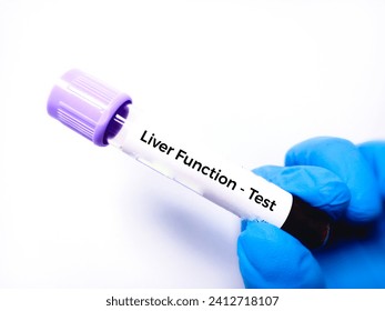 Liver Function Test (LFT)