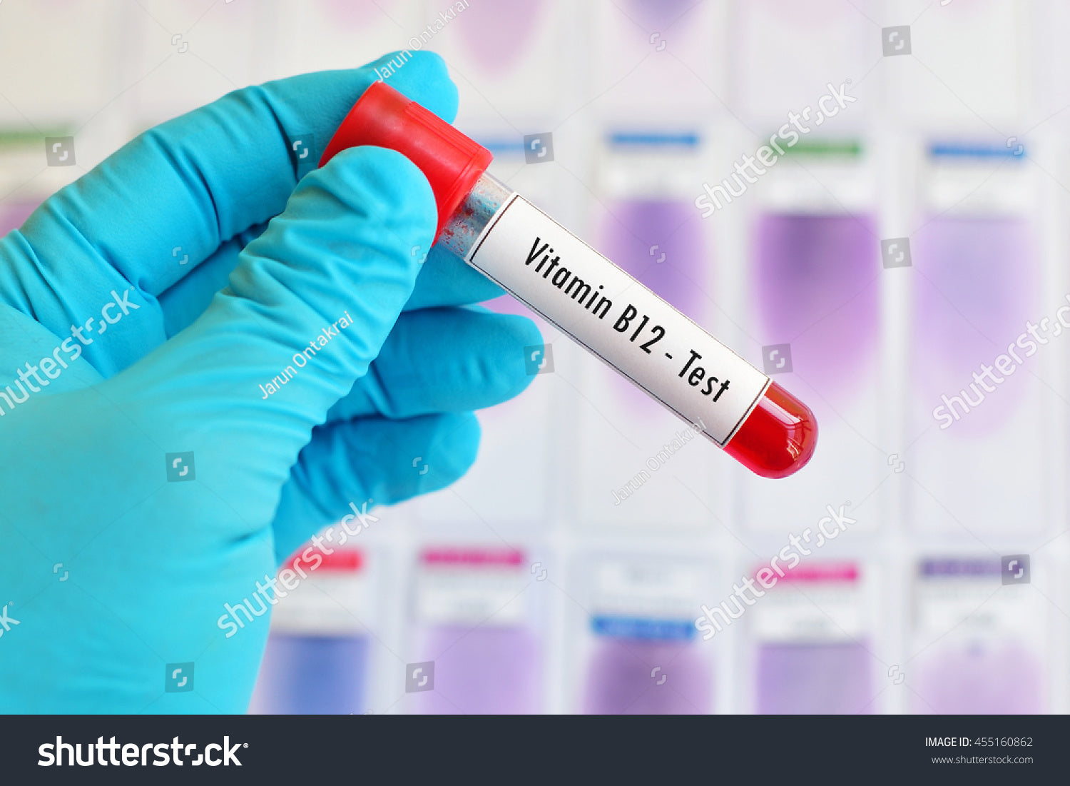 Vitamin B12 Test