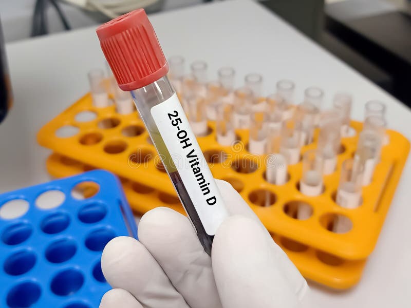 Vitamin D (25-OH) Test
