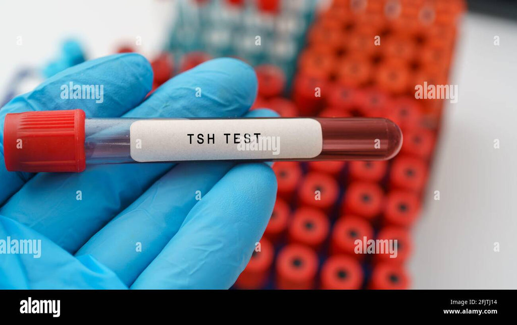 Thyroid Function Test (TSH + T3 + T4)