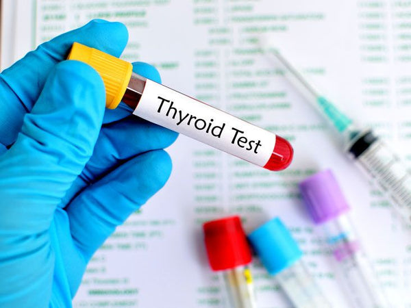 Thyroid Function Test (TSH + T3 + T4)